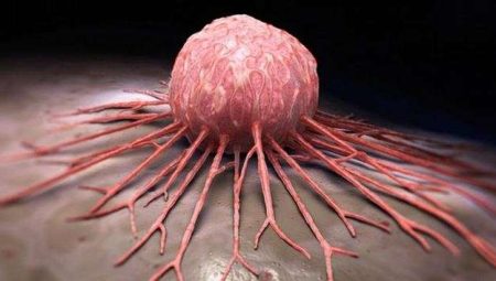 Kanser tedavisinde çığır açan hücreler Türkiye’de üretilecek